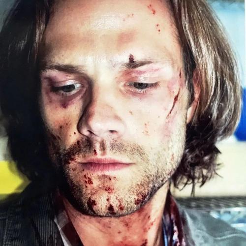 BeePantiesCas's tweet image. BURST MY EYES IT WILL BE LESS PAINFUL