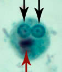 YUSci_Basma's tweet photo. This amoeba is surprised to hear that it's completely harmless #parasitology http://t.co/okdRbD1MAC