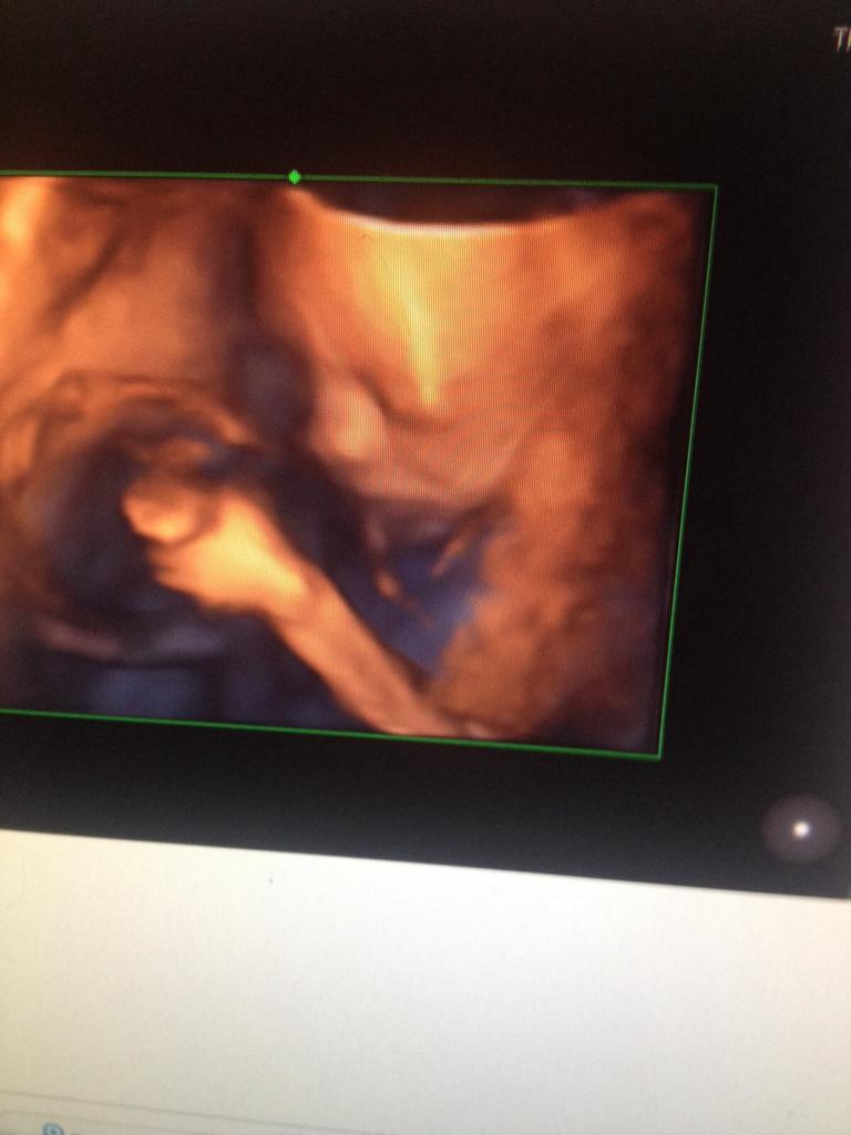 ak_myself's tweet photo. Can't wait for my grand daughter to arrive I think we have 14 weeks left an already she looks amazing xxx http://t.co/0AKUBpa0h4