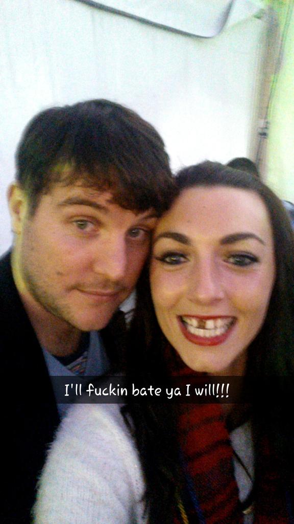 sarah_mc1986's tweet photo. Two can play that game Fran #lovehate #nofronttooth #footballinjury @RTEgaa http://t.co/IsgYnrRGOd