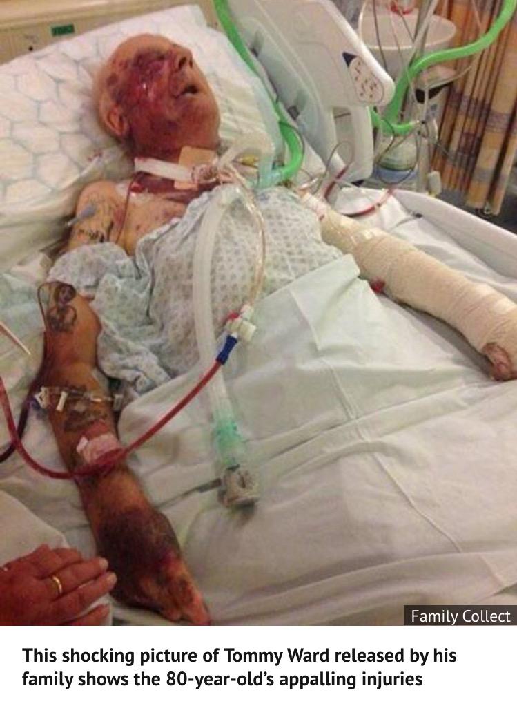Please RT - This is ex soldier 80yr old Tommy Ward nearly beaten to death for his life savings! Find who did this!