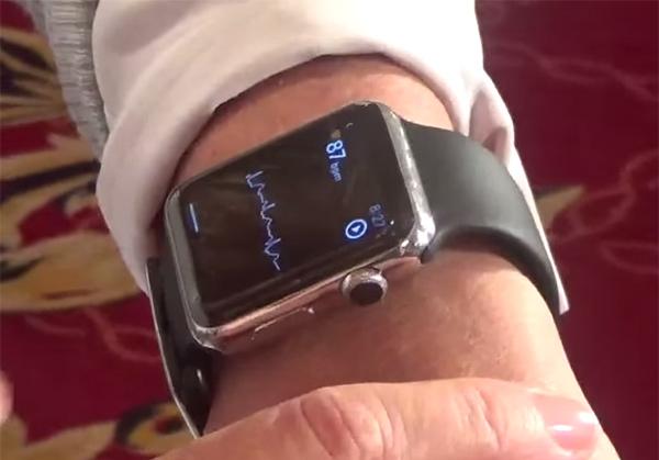 GizmoMD_'s tweet photo. AliveCor Previews Apple Watch ECG (VIDEO) http://t.co/9dl5VOTS29 http://t.co/5Hury0SEk4