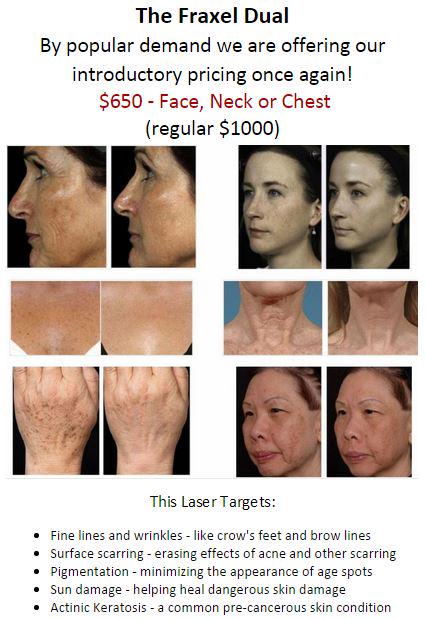 ReviveMD's tweet photo. This month save $350 OFF Fraxel Dual. Face, Neck or Chest! Complimentary consultations! 805-771-8478 http://t.co/VNCbijB2uI