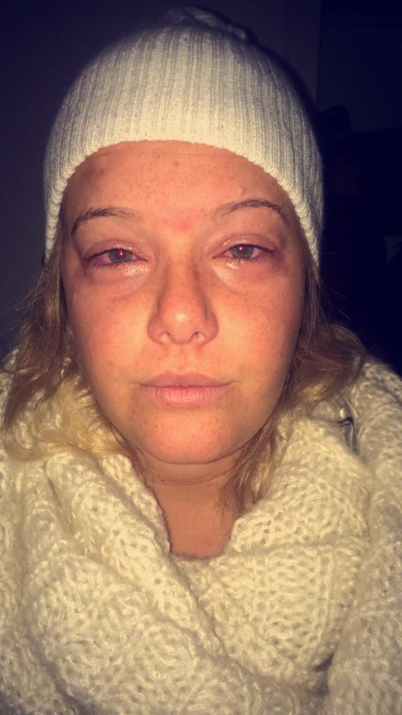 Teadahl's tweet photo. När man har lite svårt att acceptera att man är allergisk mot hundar http://t.co/4taBIO5ciD
