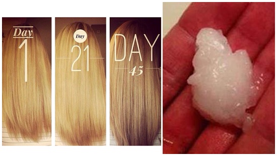 BeFitHeaIthy's tweet photo. My hair is 3 inches longer ALREADY!!😁Every girl needs to know this hair fix👉http://t.co/OyoD3cWa5s http://t.co/tz9p9NufZ2