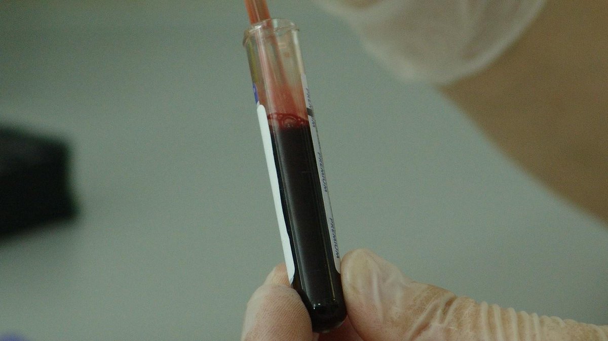 novapbs's tweet photo. A new blood test could help determine if a patient is—or will be— suicidal. http://t.co/PlK72dKSdG #NOVAnext http://t.co/y3BqFH6d6k