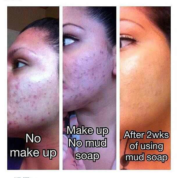 cateyes714's tweet photo. Seacret products . Heals and recovers self confidence ! #seacret.  http://t.co/S3olOO62mM .. Health wellness http://t.co/wFxRsNdFQH
