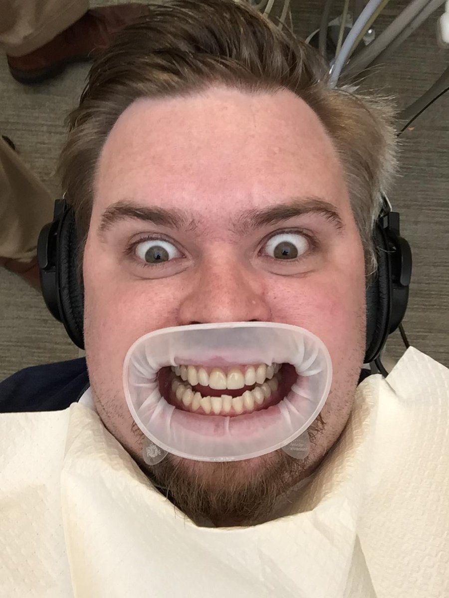 JonnyEFL7's tweet photo. Scary photo for October: my @Ivoclar_US #optragate selfie. http://t.co/s20vAgjdRJ