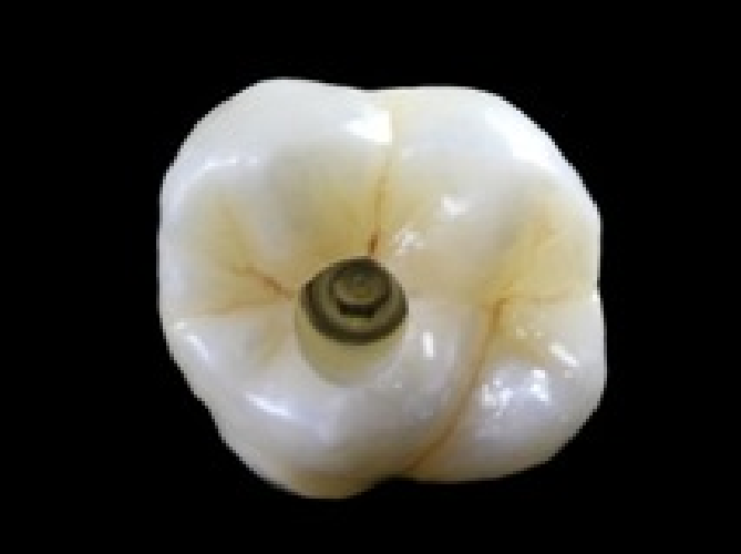 RT <a href="/SpearEducation/">Spear Education</a>: Click bit.ly/1GHlyEF to see how clinicians can ensure long-term implant success