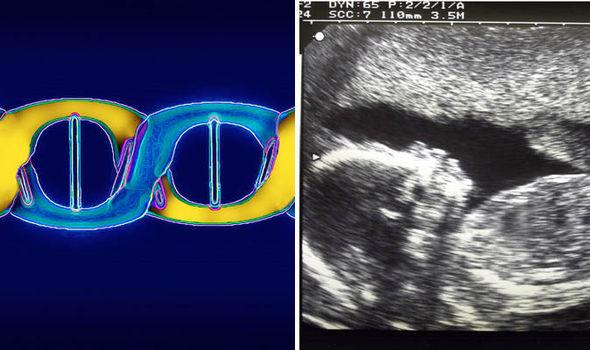 ACT_Dublin's tweet photo. Infertile mothers pass on DNA to baby, research says https://t.co/OTfTjnSWda http://t.co/d8naCOeDUr