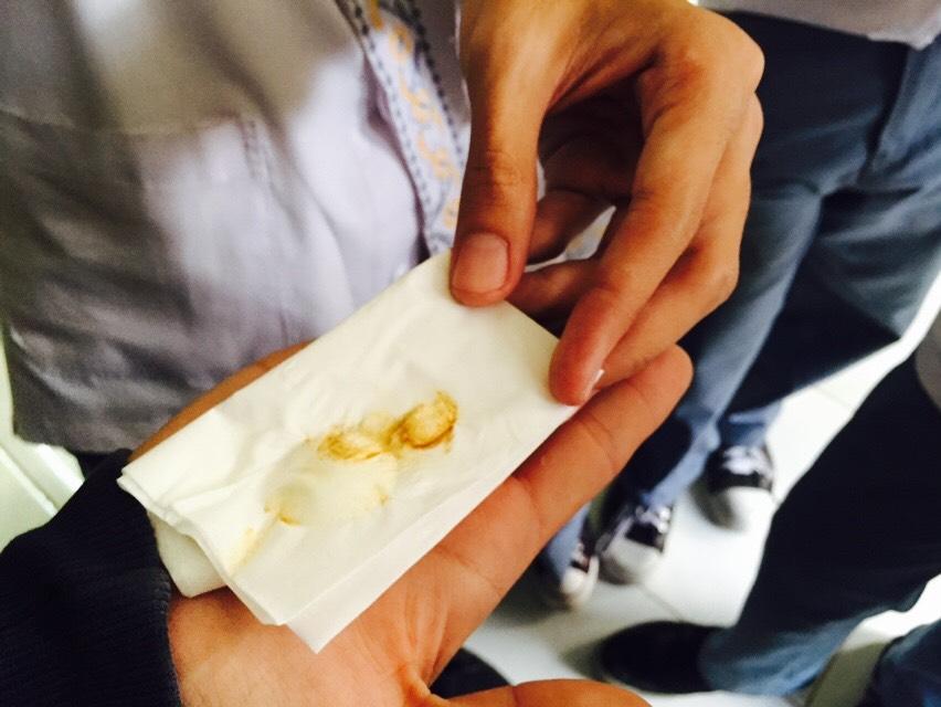 KIRSMAN51's tweet photo. Daaannn tadaaaa 😏😏😏 ini hasilnya efek rokok btw itu nikotinnya ya :"3 coba bayamgin tu nempel do paru" kalian ?!! 😧 http://t.co/C0ECU74pP6