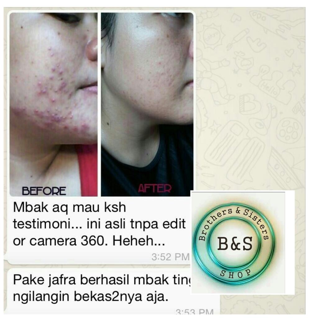 tha_278's tweet photo. @ayla_carla hi sis cb perawatan utk jerawat dari Jafra yuk?Sdh ada BPOM dan sertifikat MUI. Bisa line ke berthaliu78 http://t.co/gLDIntGNh7