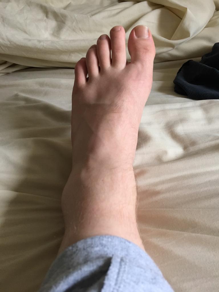 FreshWorker's tweet image. Out for the season with this ankle #football @powerleagueUK #Stockport