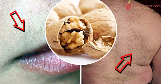 nutrilover's tweet photo. How To Remove Hair From The Face And ... – http://t.co/qmzJ32DwXR – #AncientRecipe #BeautyTips #RemoveHair http://t.co/TPXkr1twx3