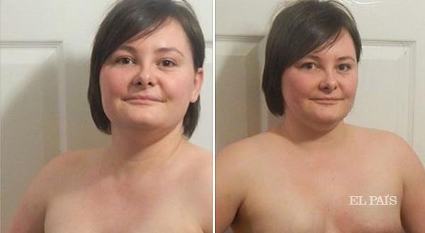 el_pais's tweet image. Estas mujeres no se avergüenzan de haber perdido sus pechos por el cáncer ow.ly/TySsR Su lucha, en @verne
