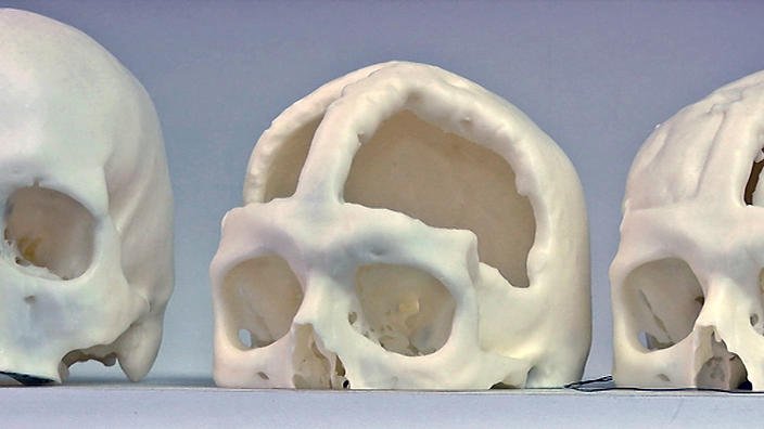 3dprintindustry's tweet photo. Researchers to 3D print skulls with stem cells https://t.co/lYTPJzIx6K via @3dprintindustry #3dprinting https://t.co/S0R93osRnc