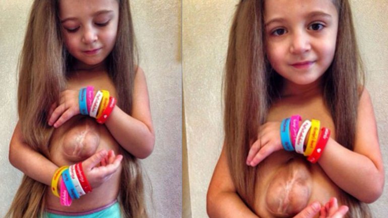 FFQuakeProject's tweet photo. La niña de seis años que nació con su corazón fura de su pecho movilizó a miles de personas https://t.co/1sJ7jIQfXJ https://t.co/6C46O5fzoe