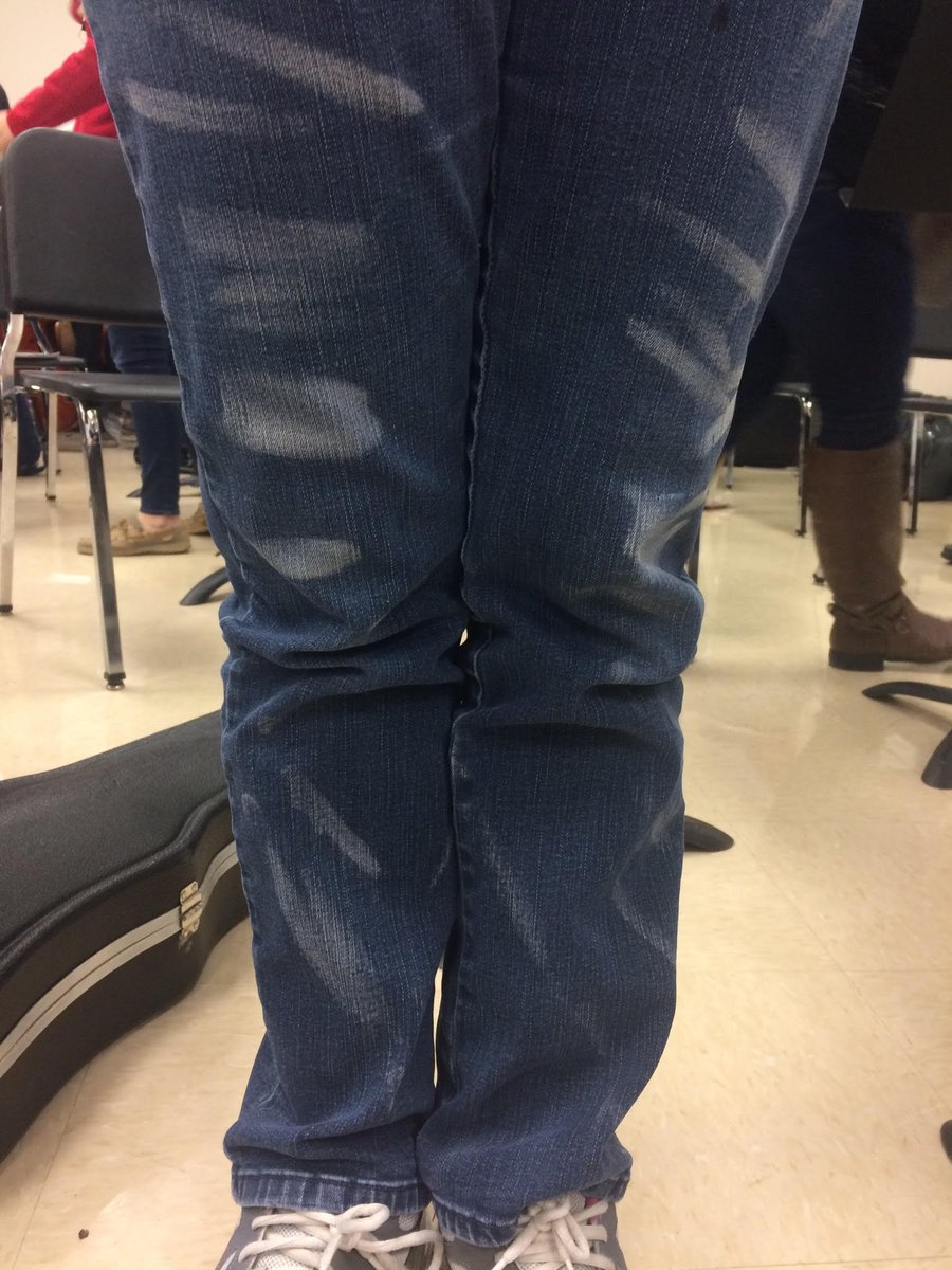 SkeletonJukebox's tweet image. Hardcore musicians have rosin stripes #orchdork #orchestraproblems