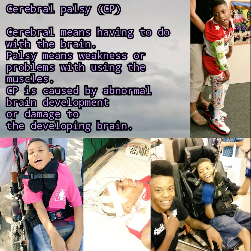 JacahsLadder's tweet photo. It's Monday! Shaken Baby Syndrome leaves life long scars! #TeamJacah #LoveHasNoDisability #JacahsLadder #NeverShake https://t.co/t7tMhcOg1B