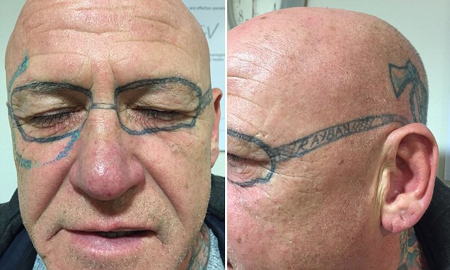 Despierta con gafas tatuadas en la cara CS1cfvLW4AA-JVa