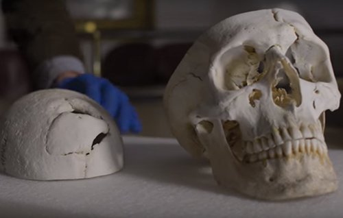 GENbio's tweet image. #GENvideo: Lessons of the brain, and the case of Phineas Gage. Watch now: ow.ly/U8RdT