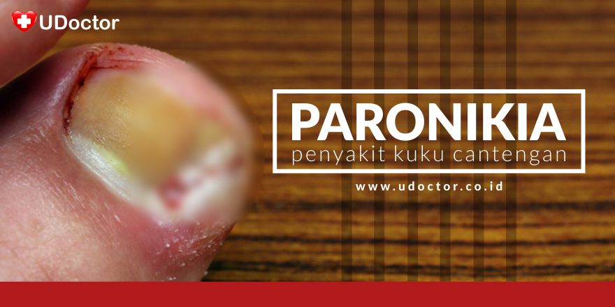 UDoctorID's tweet photo. Apa itu Paronikia? Penyakit Kuku Cantengan ada yg pernah mengalaminya? https://t.co/ZRIq7SaLZG https://t.co/8c6qMbheJJ