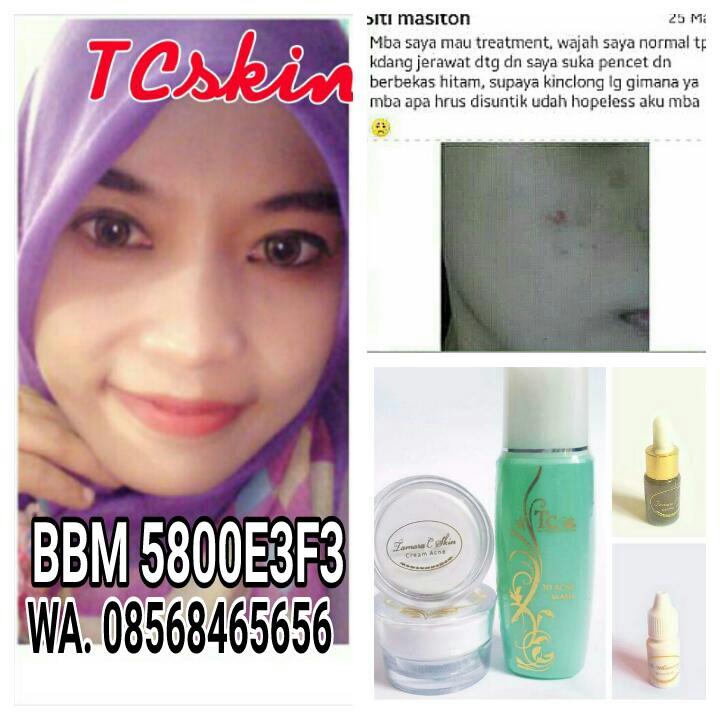 mulusdotcom's tweet image. goo.gl/1rZzUT 
tcskin.blogspot.com
Info order : 
bbm 5800e3f3 /WA. 08568465656