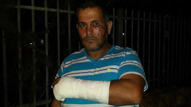 ynetnews's tweet photo. Druze citizen: 'I was attacked for speaking Arabic'
https://t.co/o32pz0Ccmx https://t.co/JaOAkzUxLQ
