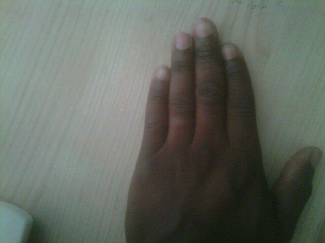 blomerbp tweet picture