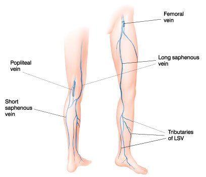 LTDTTL_F15's tweet photo. The small saphenous vein drains into what structure? https://t.co/QwcJjA7Qig