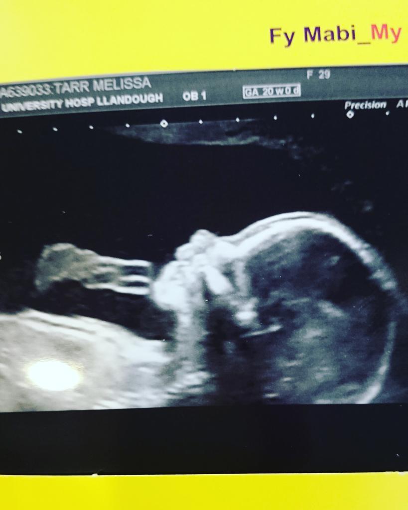 20 week scan and all is gooooood. A sister for Ollie :-D :-))