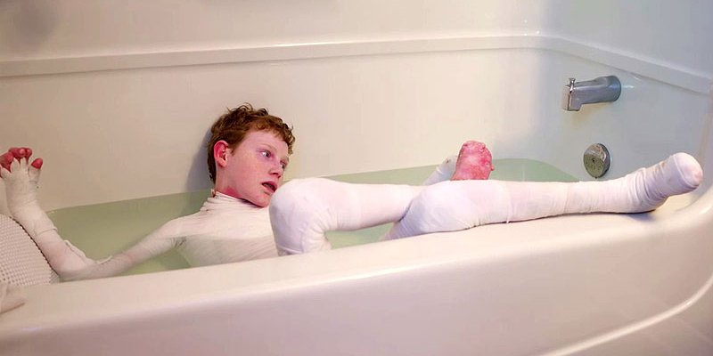 people's tweet image. Nothing—not even a skin disease!—will stop this teen from making his dreams a reality peoplem.ag/UFqoH9E