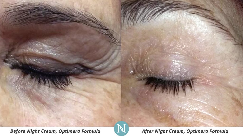 NeriumIntlMex's tweet photo. Aleje las oatitas de gallo con el desafío de Nerium crema anti edad. https://t.co/AhZJVExNeo