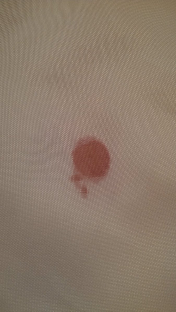 Sk7Info's tweet photo. Here SK7 removed a red wine stain in less than a minute. #RemoveStains #ThinkClean #ThinkSafe https://t.co/WDQyH0OjNA