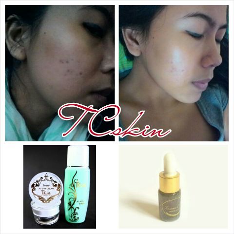 mulusdotcom's tweet image. goo.gl/1rZzUT 
tcskin.blogspot.com
Info order : 
bbm 5800e3f3 /WA. 08568465656