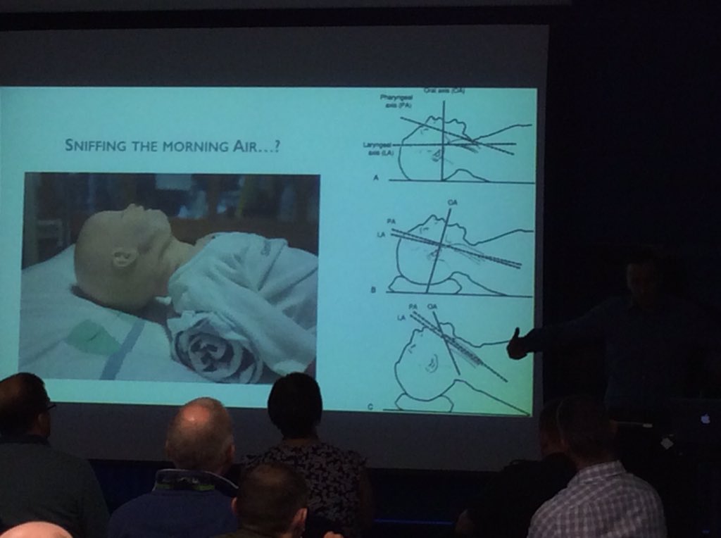 ParamedicsScot's tweet photo. @jonmcck tells us that managing paediatric airways are easy #positioning #stepwiseapproach https://t.co/r2SGC9tb7i