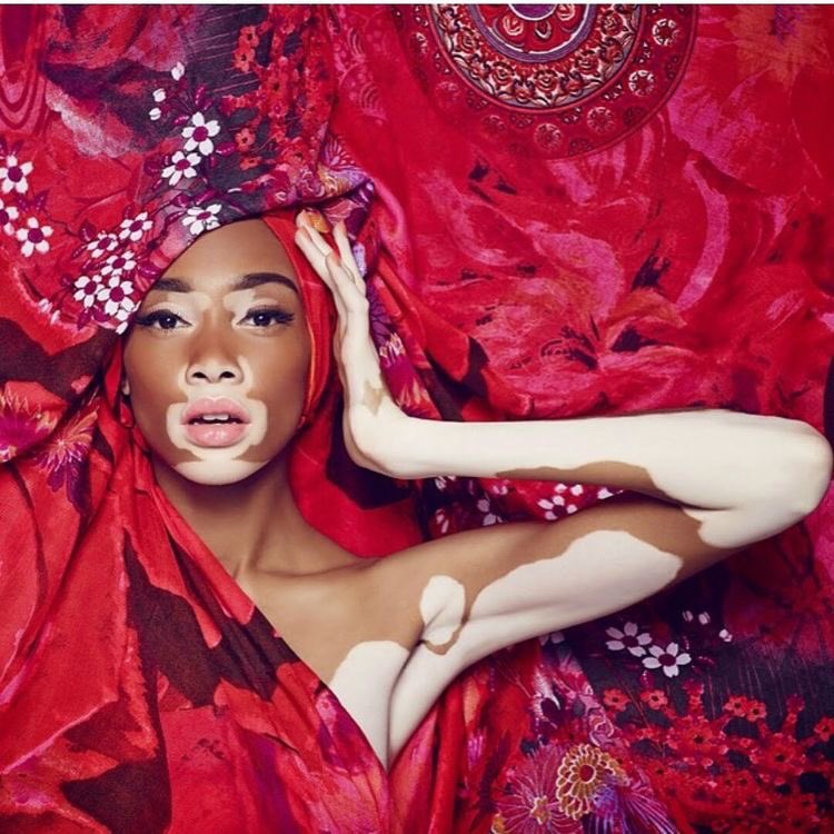 emmeverderio's tweet photo. #SmartCitizen #integrazione @winnieharlow #different means #beauty https://t.co/mJFyTORaWo