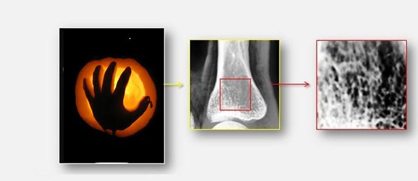cosmi_francesca's tweet photo. #Bones quality from hand radiograms on #SimulationFriday #SimulationTrick #SimulationGirls https://t.co/Rj7QVaX6Np