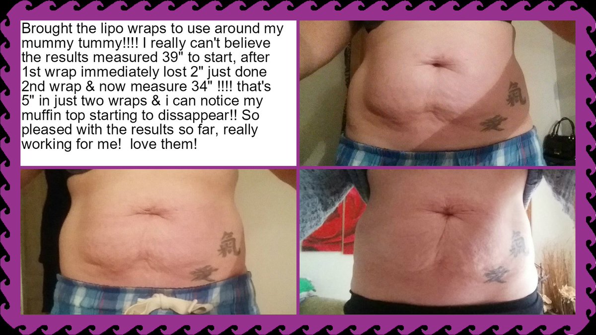 Hollylt85's tweet photo. #loveactiderm https://t.co/Njyp3Eygna