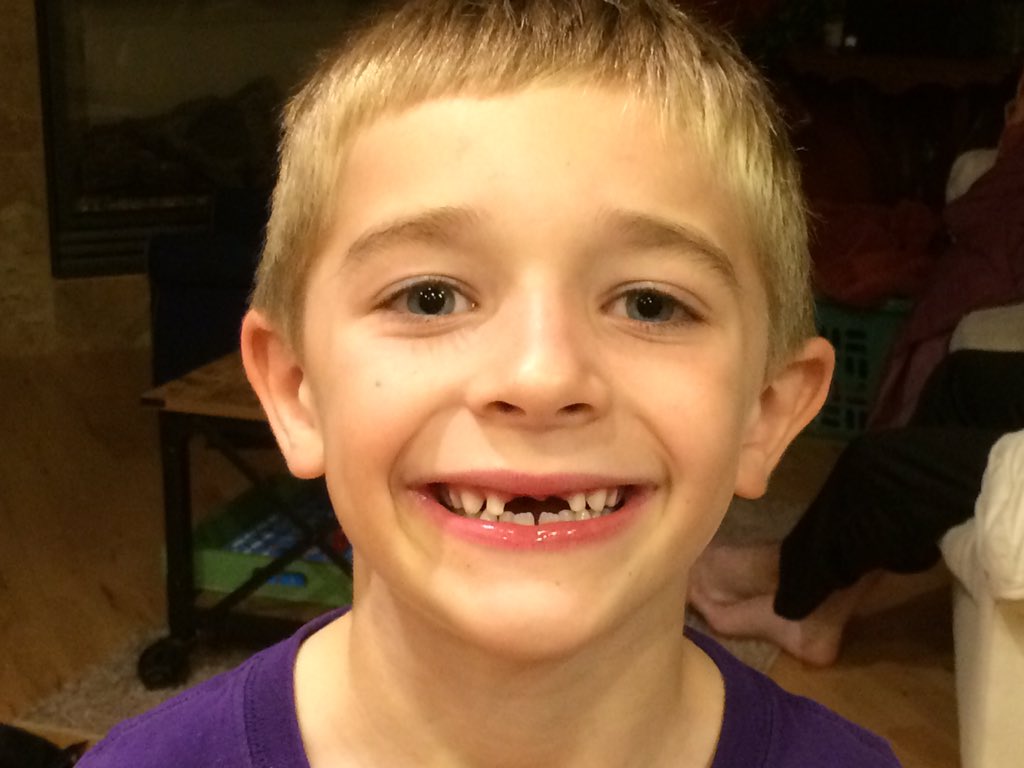 krisjorgs's tweet photo. The tooth fairy has been very busy at my house this week! https://t.co/9FBtFOXMpn