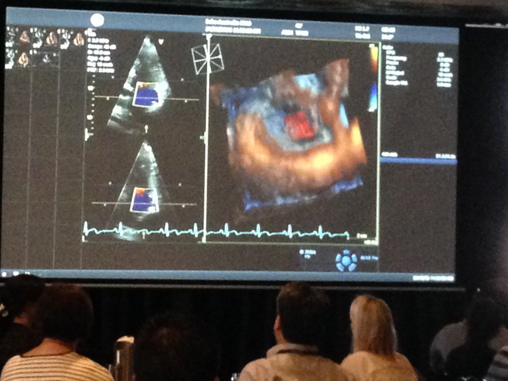 Matt Tucker On Twitter Echoau15 Very Informative 3d Live