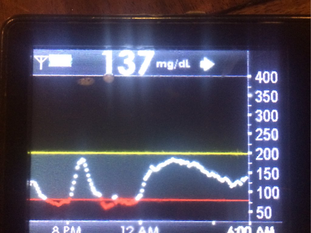 type1cycling's tweet photo. Early morning start on #transisrael this am. Bad night of hypos didn't help with getting enough sleep #diabetes. https://t.co/ZI2rwliYjH