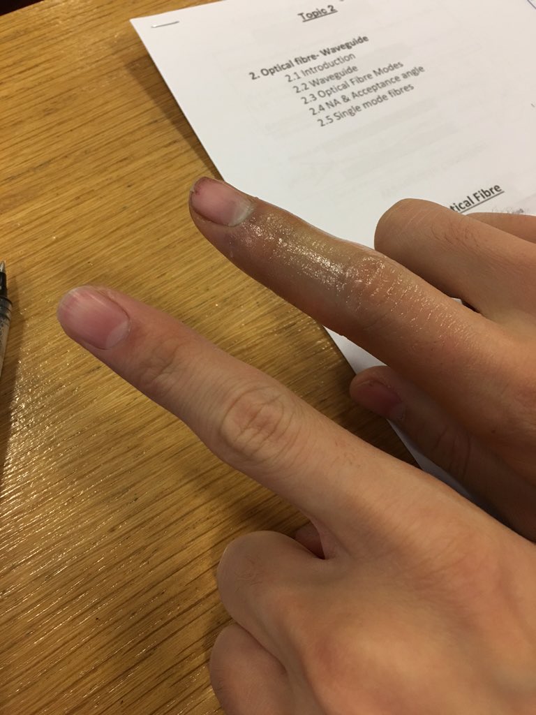 MARS VUITTON CHAIN tweet media