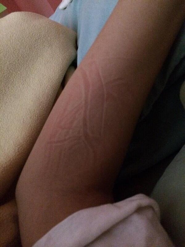 You know your nap was good when u wake up with one of these