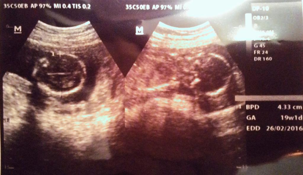 linalinadewi's tweet photo. Hello ma baby.. https://t.co/SNWnjQ5j9p