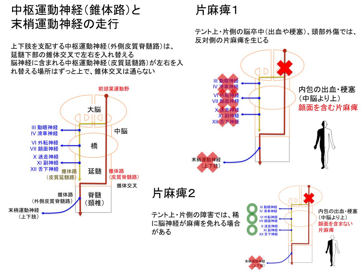 Oj Di Twitter 中枢運動神経麻痺1 片麻痺 錐体路 中枢運動神経の走行路 は左右を入れ替える 上下肢の中枢運動神経 は延髄下端の錐体交叉で左右を入れ替えるが 脳神経に含まれる中枢運動神経が左右を入れ替えるのはずっと上 T Co Idfxh3ppf4