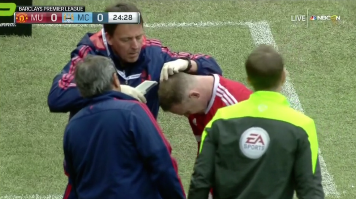 NBCSportsSoccer's tweet photo. .@WayneRooney just got his head stapled on the pitch and continues to play in the #ManchesterDerby #BPLonNBC https://t.co/eHfk0CHUqa