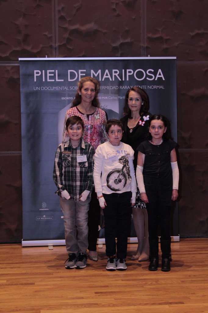 dobleduo's tweet photo. Día Internacional @pieldemariposa ayer estuvimos en la Première https://t.co/4UiWPwdh4H no dejes de verlo #PonteAlas https://t.co/5kaBgbaXqK
