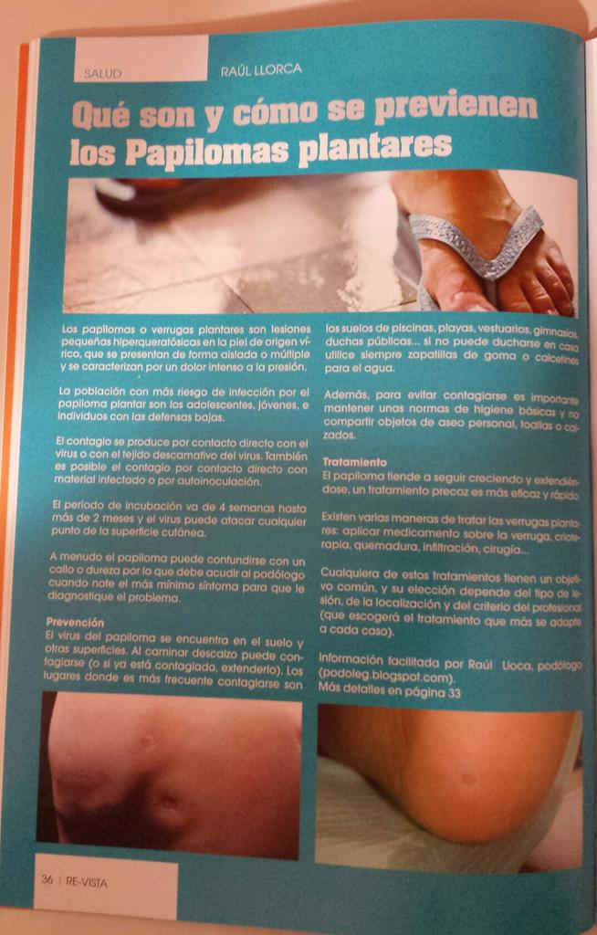Podoleg's tweet photo. Qué son y cómo se previenen los Papilomas plantares #salud https://t.co/c0JoH5uXx9