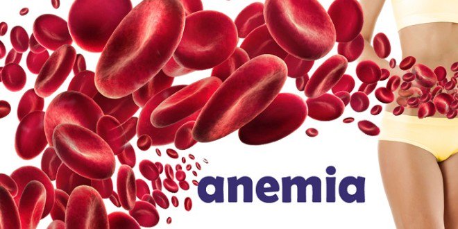 yhealthtips's tweet photo. Try out these natural treatment to regain your red blood cells and overcome from #anemia https://t.co/o7IKO6UP2D https://t.co/xlywTgZ0UC